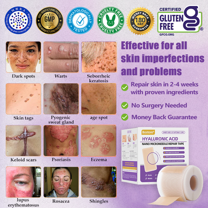 A bőr bizalmának kezdete itt van ✅ Bosstore® Hialuronsav Nano Mikrotűs Javító Tapasz ✴️ Különféle hegekre, striákra, foltokra, keloidokra, keratózisra, aknéra, égési sérülésekre, szemölcsökre, bőrcímkékre és visszértágulatokra.