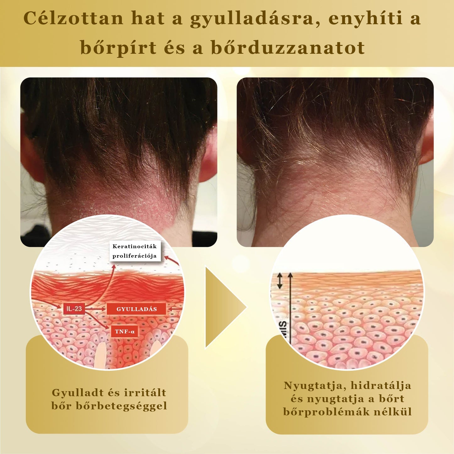 Croaie® Mellifera-méreg sűrítése bőrregeneráló krém💖