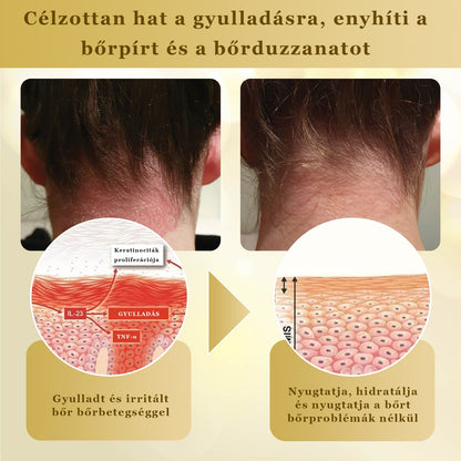 Croaie® Mellifera-méreg sűrítése bőrregeneráló krém💖