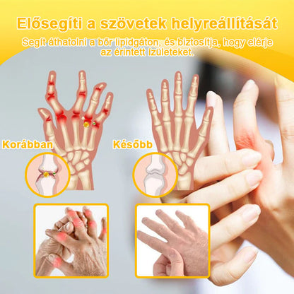 💧🐝TLOPA® Botulinum Toxin & Méhméreg Fájdalomcsillapító Csontgyógyító Krém👨‍⚕️A Magyar Ortopéd Társaság (MOT) Által Jóváhagyva
