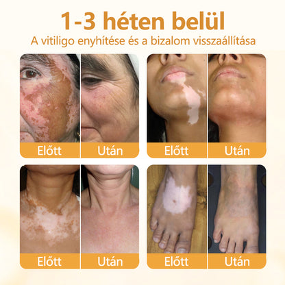 Timilk® VitiCalm méhméreg-krém🌻🌻