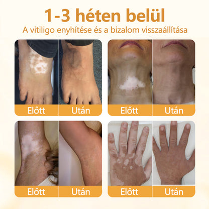 Timilk® VitiCalm méhméreg-krém🌻🌻