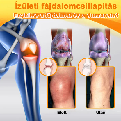 ✅Hivatalos Áruház: Ourlyard™ Magnézium Olaj és Méhméreg ízületjavító spray 👨‍⚕️ A Gyógyszerügyi Hivatal (OGYEI) jóváhagyásával.