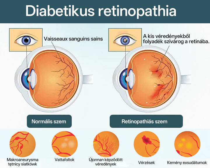 🔥Laleia® OptiFusion Nano szemcsepp szérum🎉