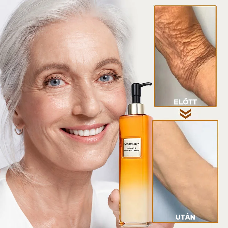 2025. évi Readers' Choice-díjasok🏆 𝐌𝐨𝐨𝐧𝐝𝐚𝐫™ 𝐟𝐞𝐬𝐳𝐞𝐬í𝐭ő 𝐟𝐢𝐚𝐭𝐚𝐥í𝐭ó 𝐤𝐫é𝐦: 𝐕𝐢𝐬𝐬𝐳𝐚á𝐥𝐥í𝐭𝐣𝐚 𝐚 𝐛ő𝐫 𝐫𝐮𝐠𝐚𝐥𝐦𝐚𝐬𝐬á𝐠á𝐭