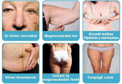 75% kedvezmény 🎉 Fubsta® Fejlett feszesítő és ránctalanító krém: Visszaállítja a bőr rugalmasságát 💧 Élénkítse fel bőrét, és ragyogjon 2025-ben! 🌟✨