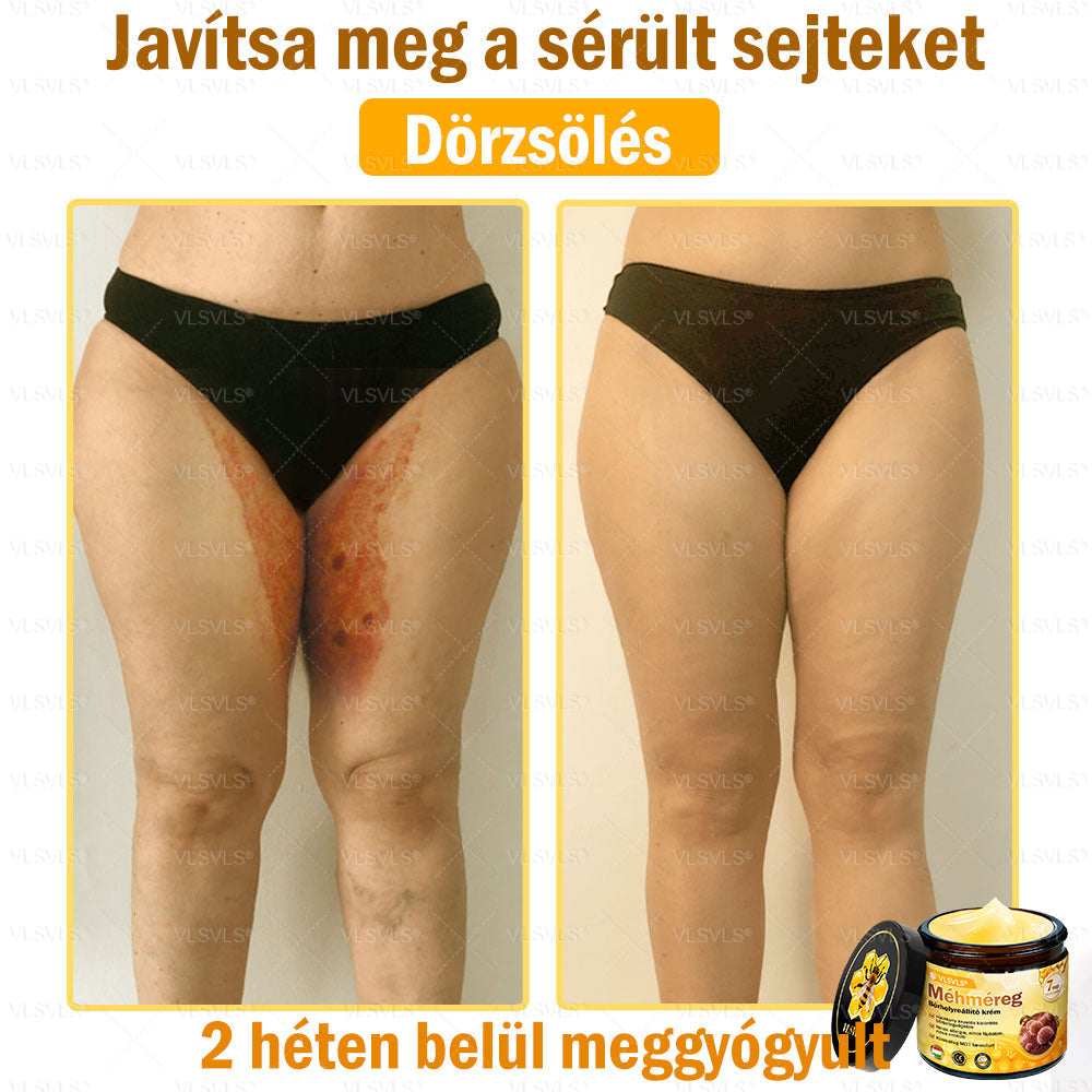 💪VLSVLS® Méhméreg Bőrhelyreállító Krém (👨‍⚕‍CE jóváhagyott)👍✅✅