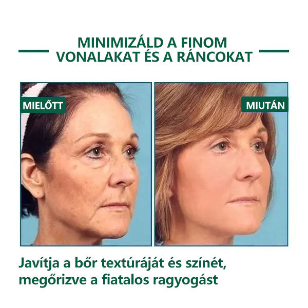 🌿💝A 60%-os akció utolsó napja - Fubsta™ öregedésgátló bőrfeszesítő szérum🔥🔥