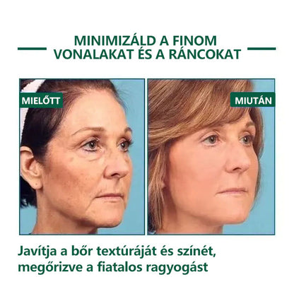 🌿💝A 60%-os akció utolsó napja - Fubsta™ öregedésgátló bőrfeszesítő szérum🔥🔥