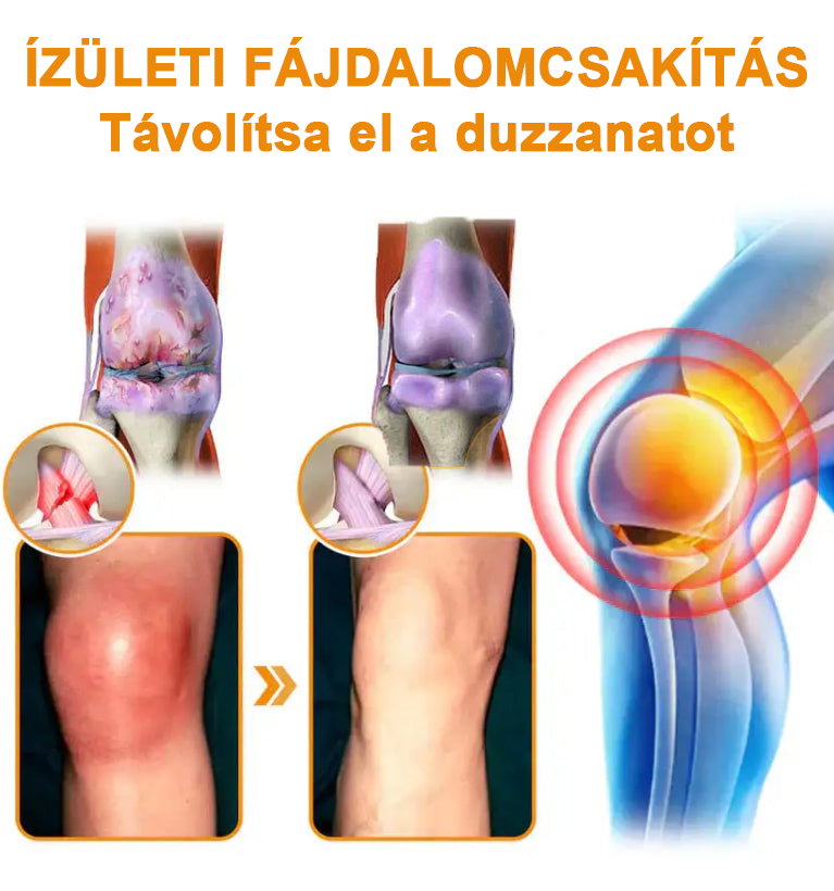 ✅Hivatalos Áruház: Ourlyard™ Magnézium Olaj és Méhméreg ízületjavító spray 👨‍⚕️ A Gyógyszerügyi Hivatal (OGYEI) jóváhagyásával.