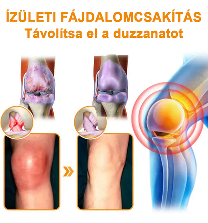 ✅Hivatalos Áruház: Ourlyard™ Magnézium Olaj és Méhméreg ízületjavító spray 👨‍⚕️ A Gyógyszerügyi Hivatal (OGYEI) jóváhagyásával.