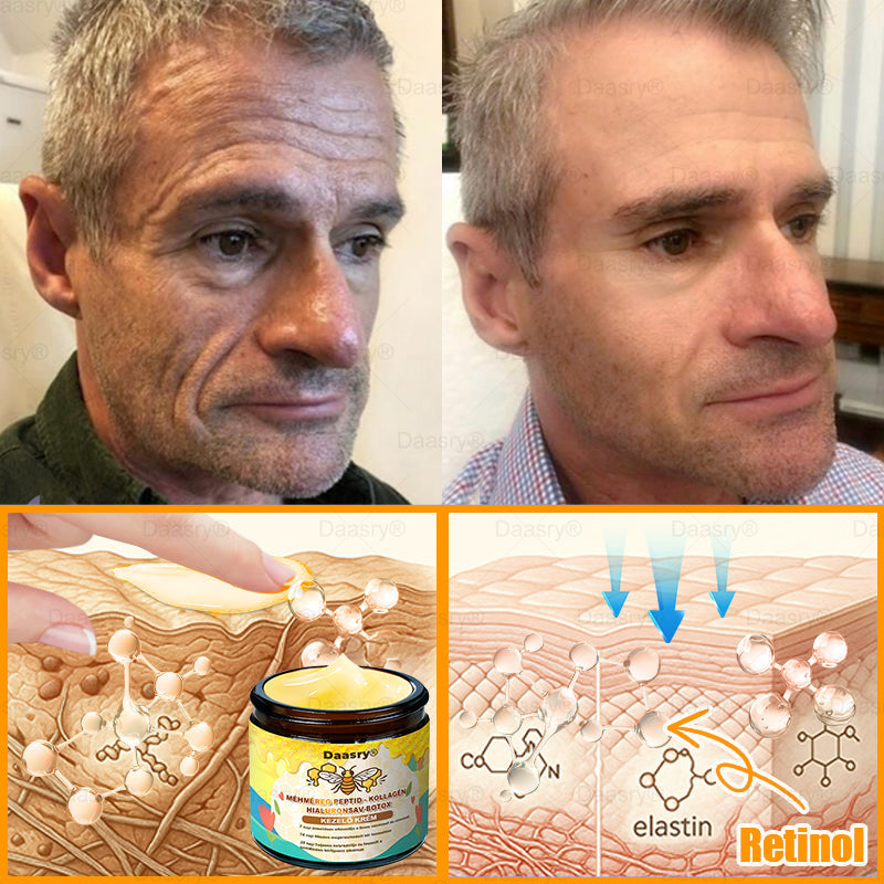 Daasry® Méhméreg Krém – Természetes bőrfeszesítés és ránctalanítás klinikai hatékonysággal! ✨✨✨