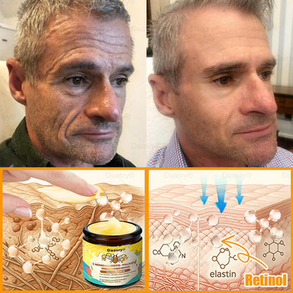 Daasry® Méhméreg Krém – Természetes bőrfeszesítés és ránctalanítás klinikai hatékonysággal! ✨✨✨