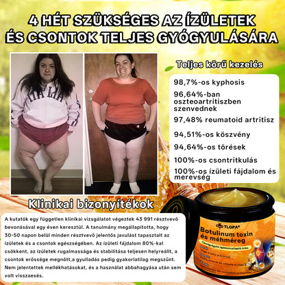 🌿🌿TLOPA® Botulinum Toxin és Méhméreg Fájdalomcsillapító Csontgyógyító Krém🐝 (Kifejezetten időseknek & ortopéd szakorvosok ajánlásával)