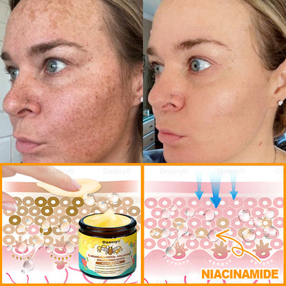 Daasry® Méhméreg Krém – Természetes bőrfeszesítés és ránctalanítás klinikai hatékonysággal! ✨✨✨