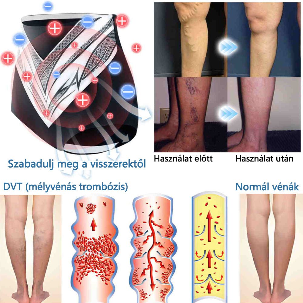 🎉 Korlátozott idejű ajánlat - hatalmas kedvezmény! 🔥 Akár 90% KEDVEZMÉNY! Sfrcord™ titánszálas önmelegedő turmalin formáló rövidnadrág✅