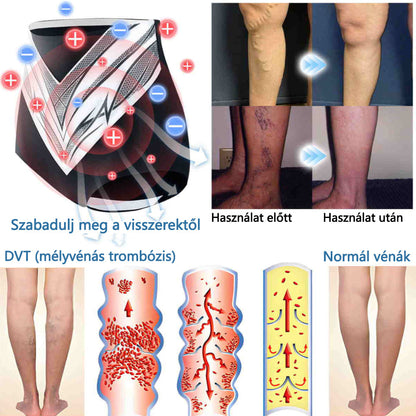 🎉 Korlátozott idejű ajánlat - hatalmas kedvezmény! 🔥 Akár 90% KEDVEZMÉNY! Sfrcord™ titánszálas önmelegedő turmalin formáló rövidnadrág✅
