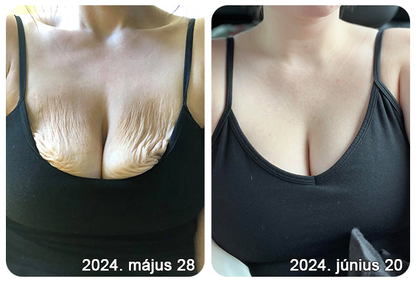 2025. évi Readers' Choice-díjasok🏆 𝐌𝐨𝐨𝐧𝐝𝐚𝐫™ 𝐟𝐞𝐬𝐳𝐞𝐬í𝐭ő 𝐟𝐢𝐚𝐭𝐚𝐥í𝐭ó 𝐤𝐫é𝐦: 𝐕𝐢𝐬𝐬𝐳𝐚á𝐥𝐥í𝐭𝐣𝐚 𝐚 𝐛ő𝐫 𝐫𝐮𝐠𝐚𝐥𝐦𝐚𝐬𝐬á𝐠á𝐭