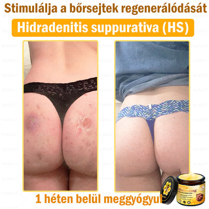 💪VLSVLS® Méhméreg Bőrhelyreállító Krém (👨‍⚕‍CE jóváhagyott)👍✅✅