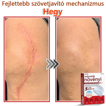 ✅KUBOZN® Mikrotűs Botanikus Bőrkinövés Eltávolító Tapaszok | Magyarországon készült