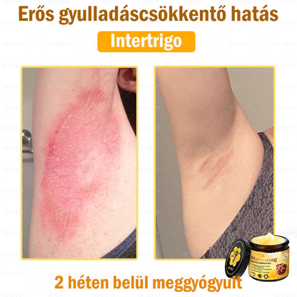 💪VLSVLS® Méhméreg Bőrhelyreállító Krém (👨‍⚕‍CE jóváhagyott)👍✅✅