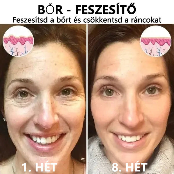 🌿💝A 60%-os akció utolsó napja - Fubsta™ öregedésgátló bőrfeszesítő szérum🔥🔥