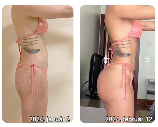 2025. évi Readers' Choice-díjasok🏆 𝐌𝐨𝐨𝐧𝐝𝐚𝐫™ 𝐟𝐞𝐬𝐳𝐞𝐬í𝐭ő 𝐟𝐢𝐚𝐭𝐚𝐥í𝐭ó 𝐤𝐫é𝐦: 𝐕𝐢𝐬𝐬𝐳𝐚á𝐥𝐥í𝐭𝐣𝐚 𝐚 𝐛ő𝐫 𝐫𝐮𝐠𝐚𝐥𝐦𝐚𝐬𝐬á𝐠á𝐭