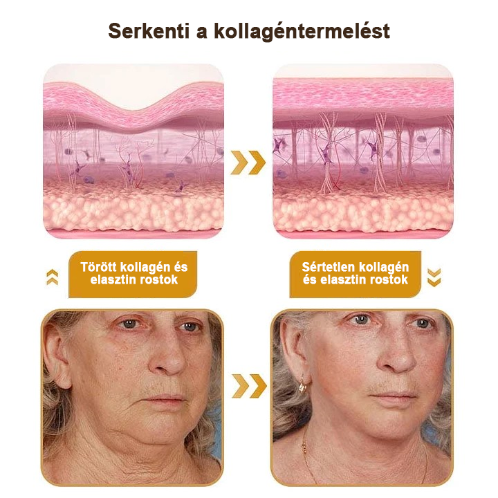 🍀Az akció utolsó napja: 83% kedvezmény✨𝐅𝐮𝐫𝐳𝐞𝐫𝐨™ Ránctalanító Krém Méhméreggel és Botox Hatással🐝