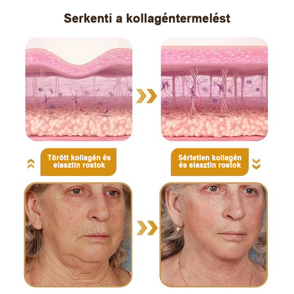 🍀Az akció utolsó napja: 83% kedvezmény✨𝐅𝐮𝐫𝐳𝐞𝐫𝐨™ Ránctalanító Krém Méhméreggel és Botox Hatással🐝