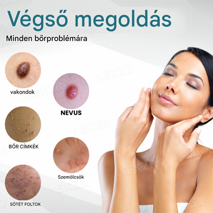 ✅✅Bikenda® non-invazív anyajegy- és szemölcseltávolító lézertoll