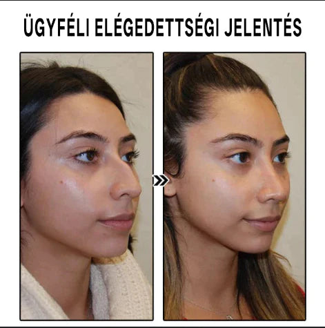 (Utolsó nap a 80% kedvezménnyel) Bikenda™ Lymphvity MagneTherapy Germanium fülbevalók🔥