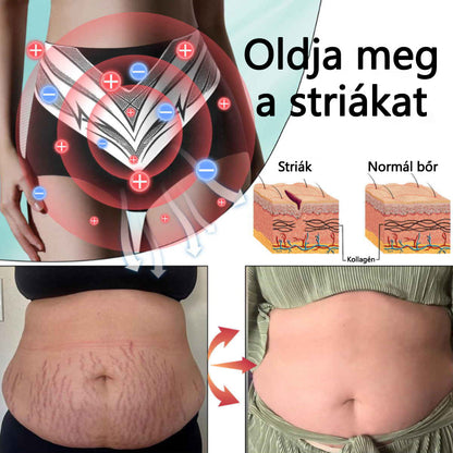 🎉 Korlátozott idejű ajánlat - hatalmas kedvezmény! 🔥 Akár 90% KEDVEZMÉNY! Sfrcord™ titánszálas önmelegedő turmalin formáló rövidnadrág✅