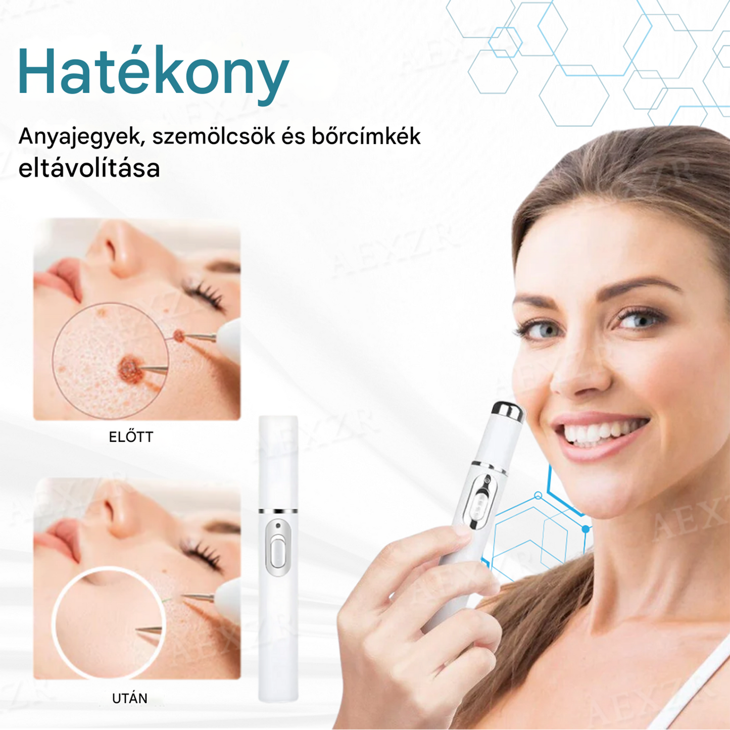 ✅✅Bikenda® non-invazív anyajegy- és szemölcseltávolító lézertoll