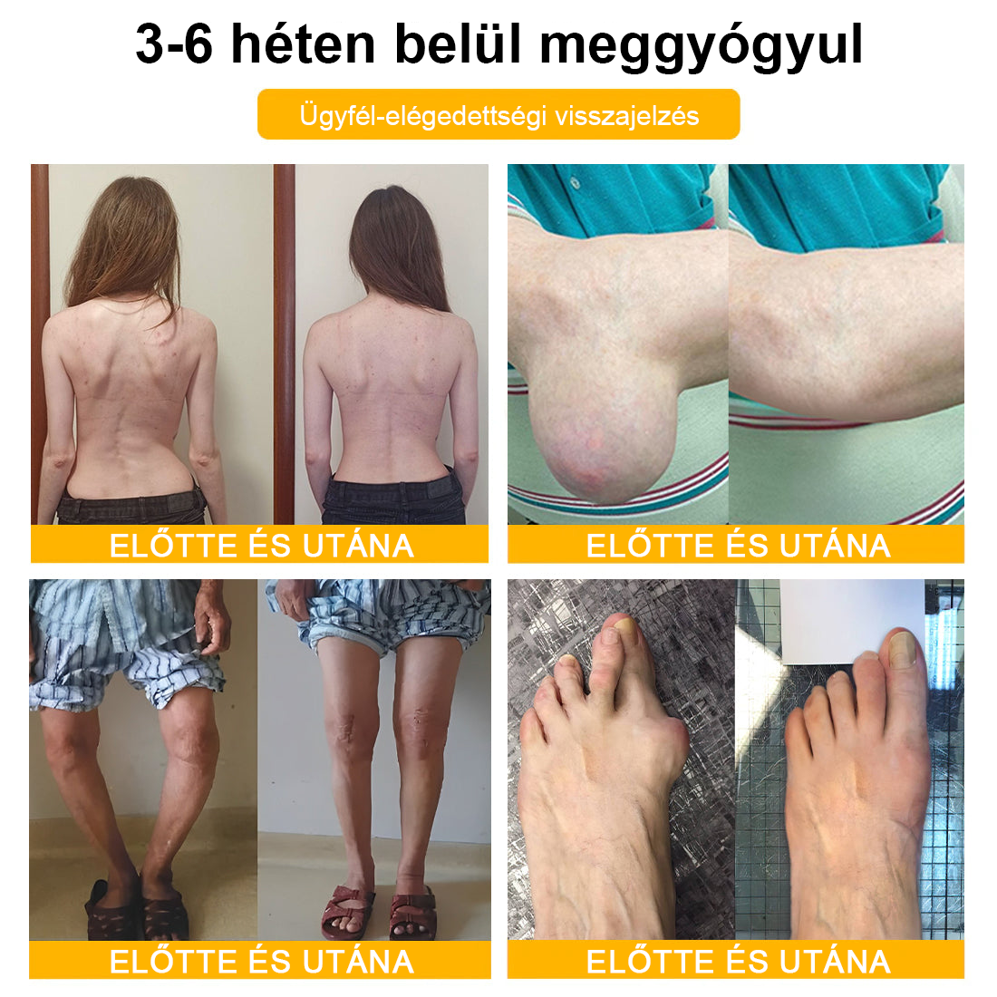 TLOPA® Botulinum Toxin és Méhméreg Fájdalomcsillapító Csontgyógyító Krém🐝🌿 (Kifejezetten időseknek & ortopéd szakorvosok ajánlásával)🔥🔥