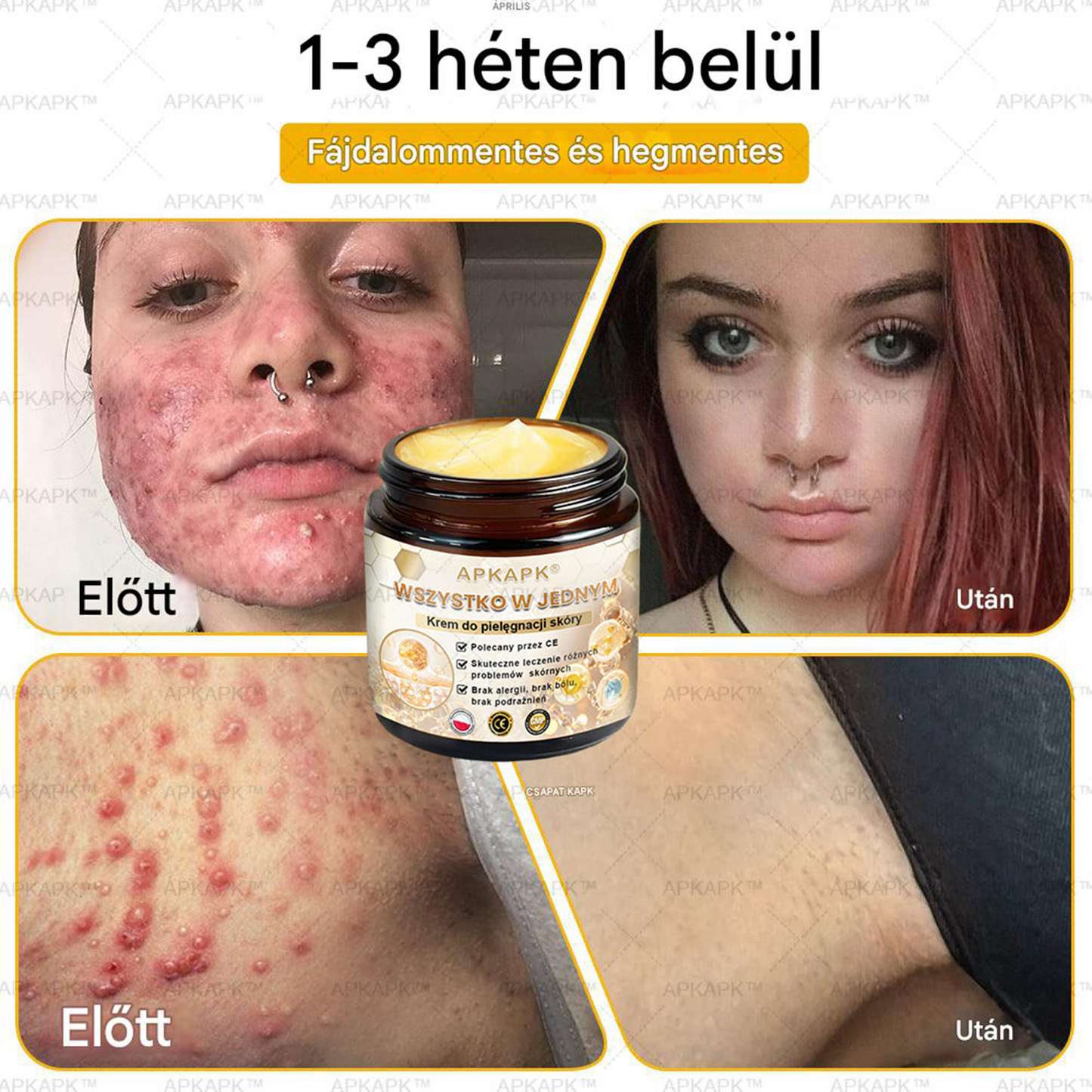 𝑨𝑷𝑲𝑨𝑷𝑲™ Hatékony krém a teljes bőrápoláshoz🔥