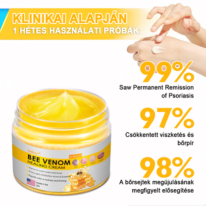 2024 ÚJ Velisse™ méhméreg bőrkrém（🧑‍⚕️AAD ajánlott), a szemölcsök, akné és hegek eltávolítására – többféle bőrbetegség kezelésére