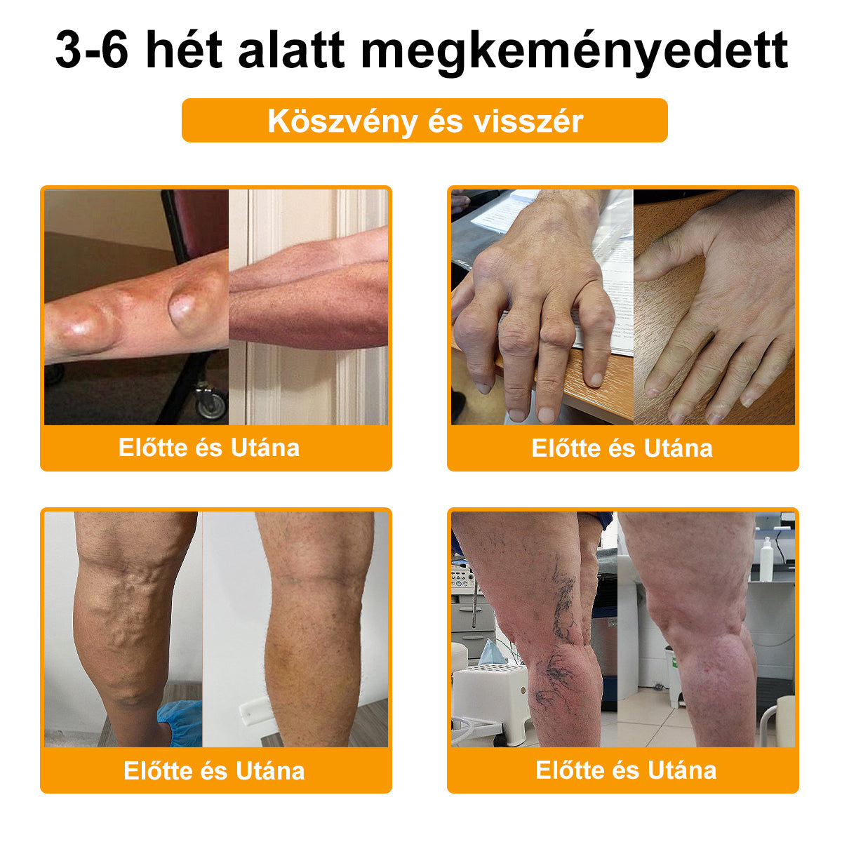 💧🐝TLOPA® Botulinum Toxin & Méhméreg Fájdalomcsillapító Csontgyógyító Krém👨‍⚕️A Magyar Ortopéd Társaság (MOT) Által Jóváhagyva