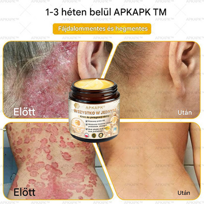 𝑨𝑷𝑲𝑨𝑷𝑲™ Hatékony krém a teljes bőrápoláshoz🔥