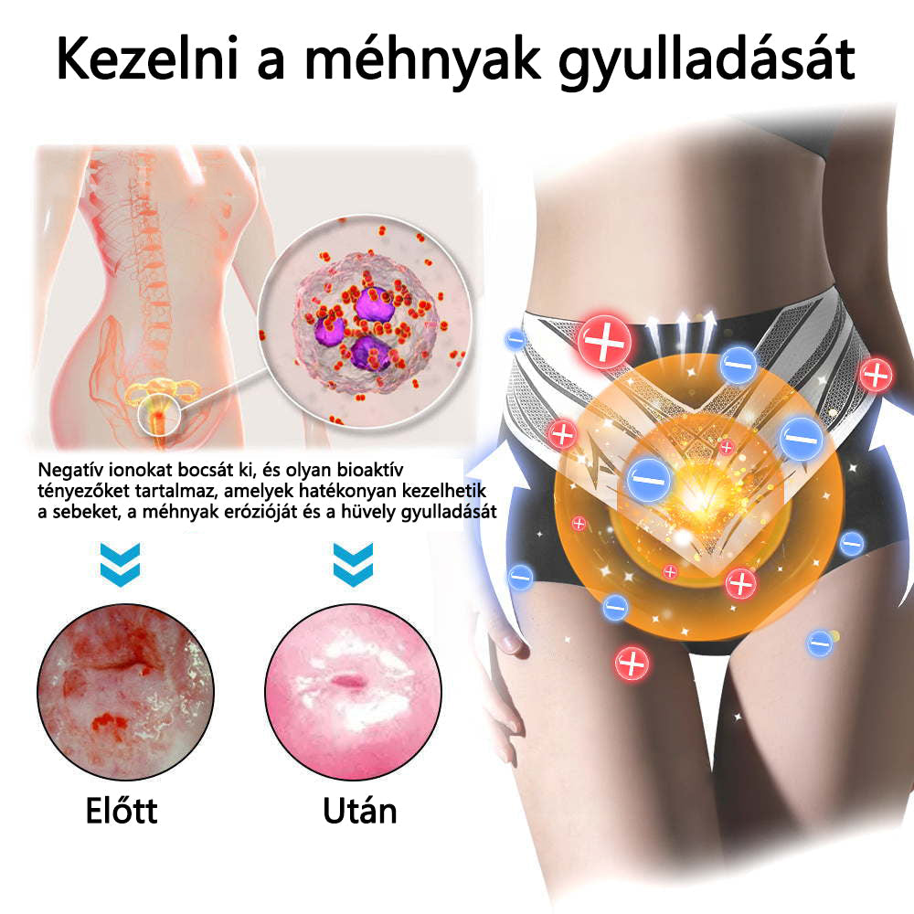 🎉 Korlátozott idejű ajánlat - hatalmas kedvezmény! 🔥 Akár 90% KEDVEZMÉNY! Sfrcord™ titánszálas önmelegedő turmalin formáló rövidnadrág✅