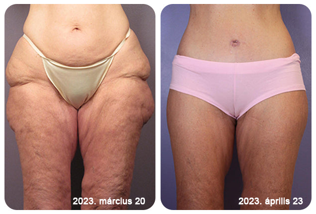 2025. évi Readers' Choice-díjasok🏆 𝐌𝐨𝐨𝐧𝐝𝐚𝐫™ 𝐟𝐞𝐬𝐳𝐞𝐬í𝐭ő 𝐟𝐢𝐚𝐭𝐚𝐥í𝐭ó 𝐤𝐫é𝐦: 𝐕𝐢𝐬𝐬𝐳𝐚á𝐥𝐥í𝐭𝐣𝐚 𝐚 𝐛ő𝐫 𝐫𝐮𝐠𝐚𝐥𝐦𝐚𝐬𝐬á𝐠á𝐭