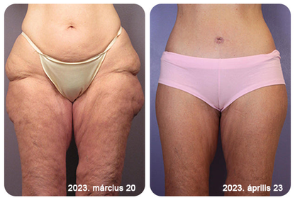 2025. évi Readers' Choice-díjasok🏆 𝐌𝐨𝐨𝐧𝐝𝐚𝐫™ 𝐟𝐞𝐬𝐳𝐞𝐬í𝐭ő 𝐟𝐢𝐚𝐭𝐚𝐥í𝐭ó 𝐤𝐫é𝐦: 𝐕𝐢𝐬𝐬𝐳𝐚á𝐥𝐥í𝐭𝐣𝐚 𝐚 𝐛ő𝐫 𝐫𝐮𝐠𝐚𝐥𝐦𝐚𝐬𝐬á𝐠á𝐭