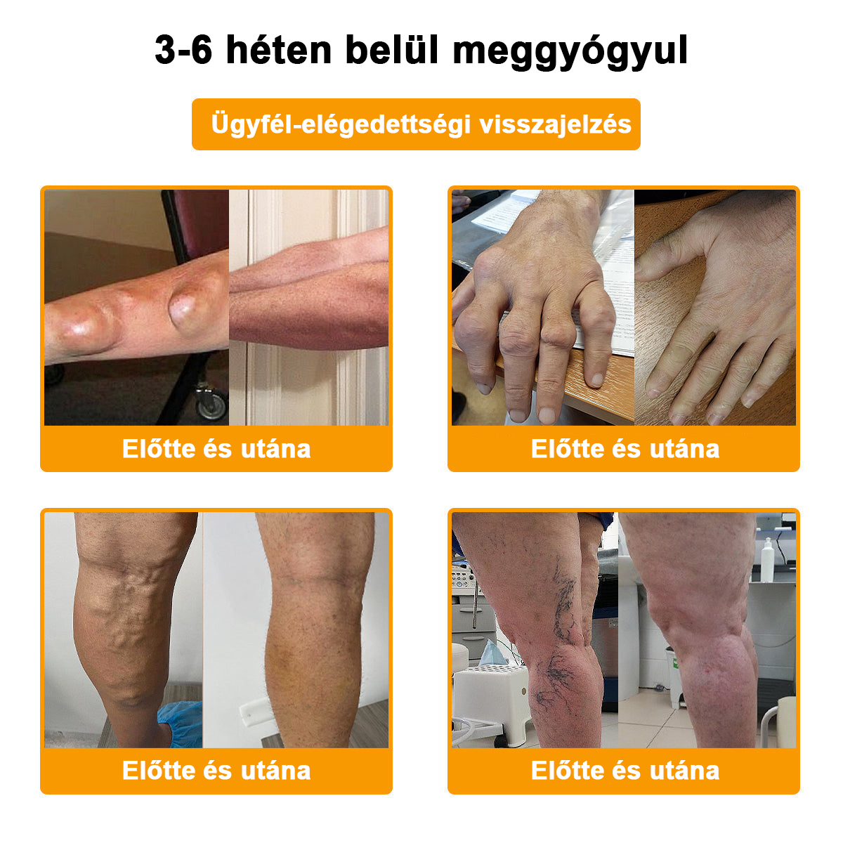 𝐀𝐫𝐭𝐡𝐫𝐨𝐅𝐫𝐞𝐞™Méhméreg fájdalomcsillapító csontgyógyító krém(Különösen az idősebb felnőtteknek és a DGOU által ajánlott) ✨Különleges ajánlat korlátozott ideig✨