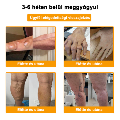 𝐀𝐫𝐭𝐡𝐫𝐨𝐅𝐫𝐞𝐞™Méhméreg fájdalomcsillapító csontgyógyító krém(Különösen az idősebb felnőtteknek és a DGOU által ajánlott) ✨Különleges ajánlat korlátozott ideig✨