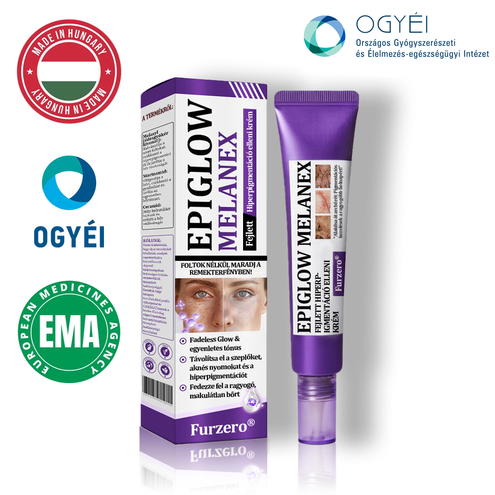 🔥🔥𝐎𝐆𝐘É𝐈 által jóváhagyva | 𝐅𝐮𝐫𝐳𝐞𝐫𝐨® 𝐄𝐏𝐈𝐆𝐋𝐎𝐖 𝐌𝐞𝐥𝐚𝐧𝐄𝐗 Fejlett Hiperpigmentáció Elleni Krém