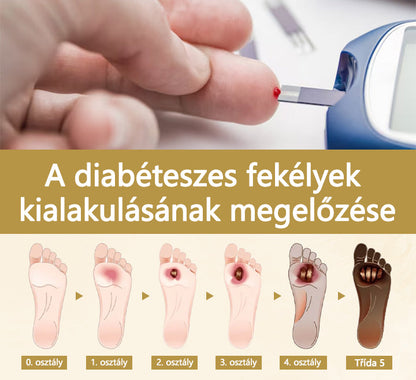 ✅Timilk® Diabetikus lábgyógyító spray - Méhméreggel átitatott