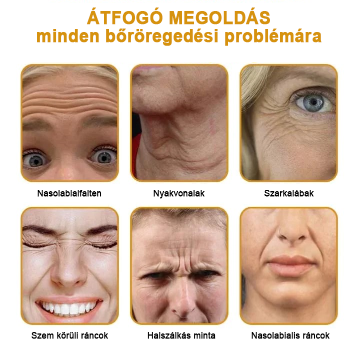 🍀Az akció utolsó napja: 83% kedvezmény✨𝐅𝐮𝐫𝐳𝐞𝐫𝐨™ Ránctalanító Krém Méhméreggel és Botox Hatással🐝