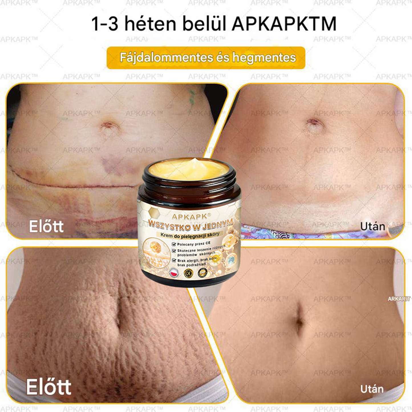𝑨𝑷𝑲𝑨𝑷𝑲™ Hatékony krém a teljes bőrápoláshoz🔥