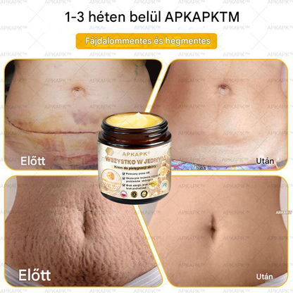𝑨𝑷𝑲𝑨𝑷𝑲™ Hatékony krém a teljes bőrápoláshoz🔥