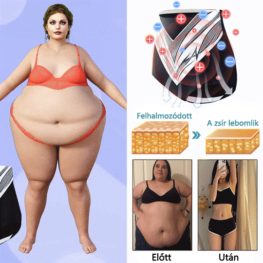 🎉 Korlátozott idejű ajánlat - hatalmas kedvezmény! 🔥 Akár 90% KEDVEZMÉNY! Sfrcord™ titánszálas önmelegedő turmalin formáló rövidnadrág✅