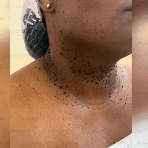 🔥🔥𝐉𝐚𝐬𝐬𝐞𝐞𝐦® Fejlett, nem invazív bőrjavító CO₂ lézeres toll 🎉 (Gyengéden eltávolítja a szemölcsöket, anyajegyeket, öregségi foltokat és bőrkinövéseket – fájdalom és gond nélkül!)